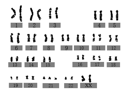 如图表示人体基因型为aabb的卵原细胞形成卵细胞的过程示意图.