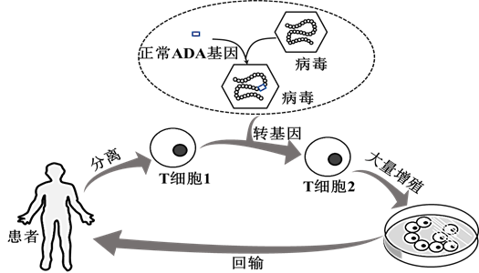 腹水腺苷脱氨酶图片